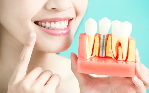 Dental implant safety assessment and treatment planning consultation
