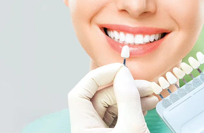 Cosmetic Dentistry in Anandbagh, Hyderabad
