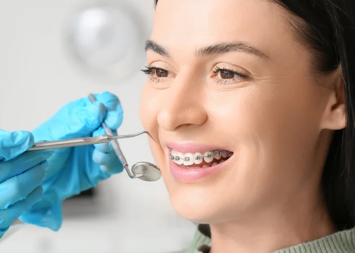 Dental Braces in Hyderabad at Dr.Sri Sushma Multispeciality Dental Clinic, Anandbagh Hyderabad