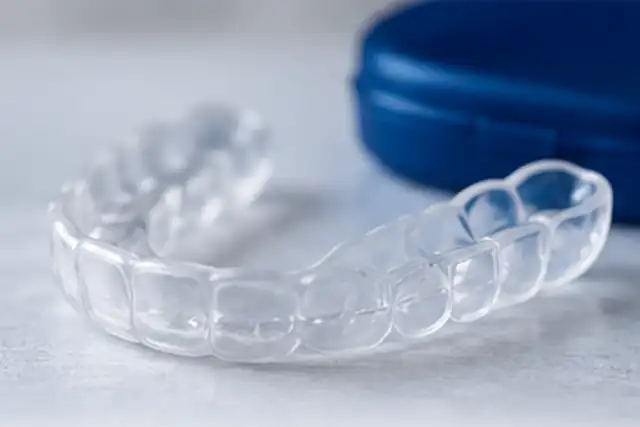 Night Guard & Bruxism Treatment in Anandbagh, Hyderabad