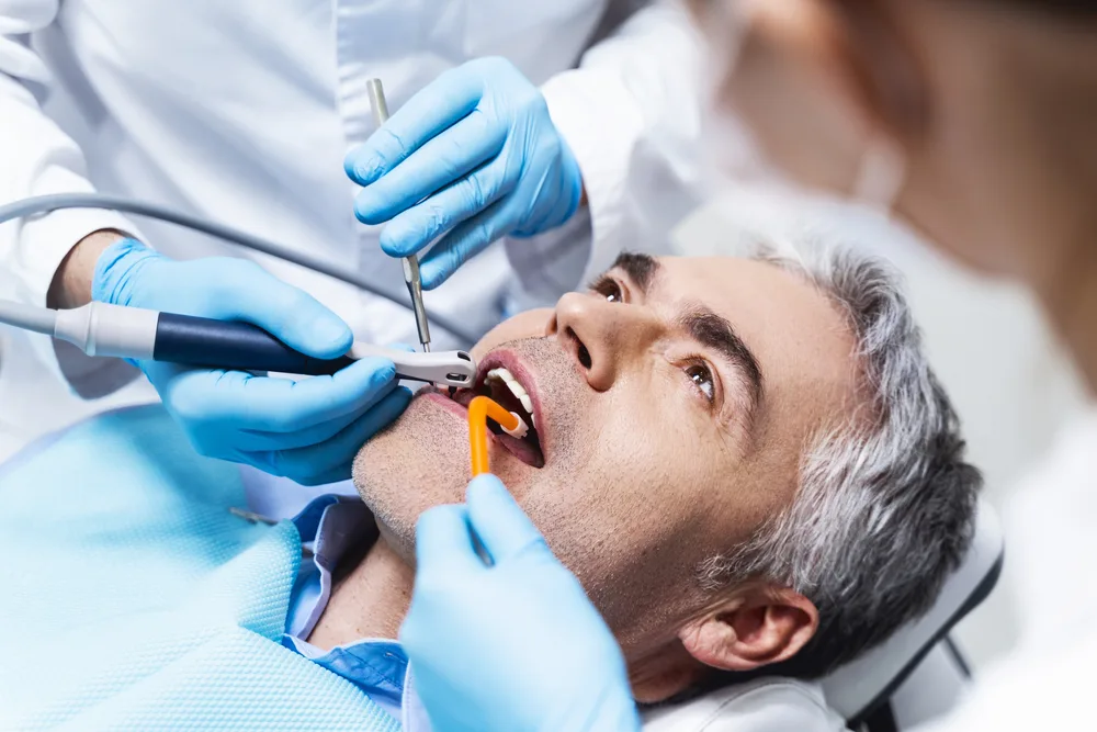 Root Canal Treatment in Anandbagh, Hyderabad