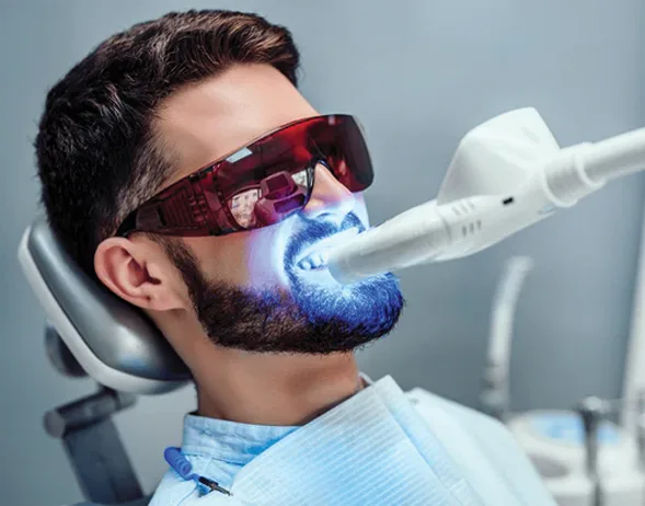 Teeth Whitening in Anandbagh, Hyderabad
